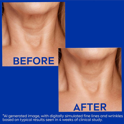 NIVEA Neck & Chest Firming Anti Wrinkle Cream with Q10, 6.7 Oz